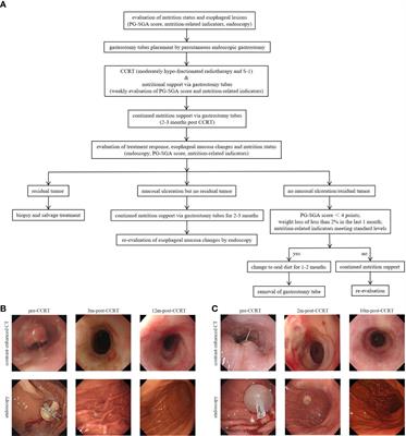 Moderately hypo-fractionated radiotherapy combined with S-1 in inoperable locally advanced esophageal squamous cell carcinoma: A prospective, single-arm phase II study (GASTO-1045)